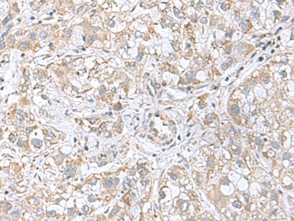 CGB5 Antibody