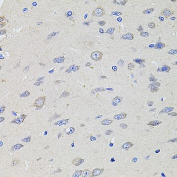 Polyclonal Rabbit anti-Human KCNJ3 / GIRK1 Antibody (IHC, WB)