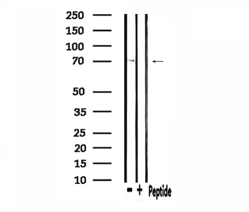RPS6KB1 / P70S6K / S6K Antibody