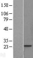 Human TNNI1 Protein (Over-Expression Lysate Myc-DDK (Flag))