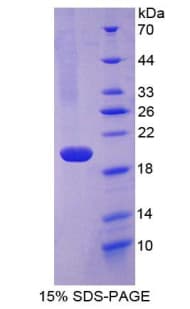 Human FBLN5 / Fibulin 5 Protein (Recombinant His-T7)