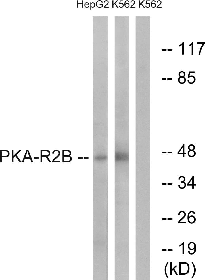 IHC-plus™ Polyclonal Rabbit anti-Human PRKAR2B Antibody (aa79-128, IHC, WB)
