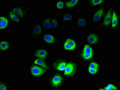 Polyclonal Rabbit anti-Human SLC36A3 Antibody