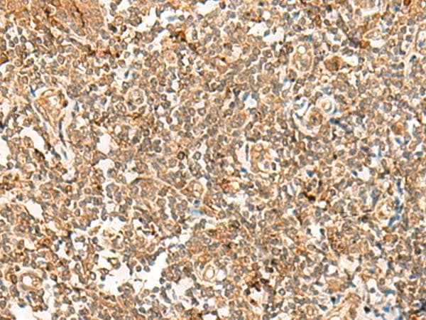 Polyclonal Rabbit anti-Human POLR1E Antibody (IHC)