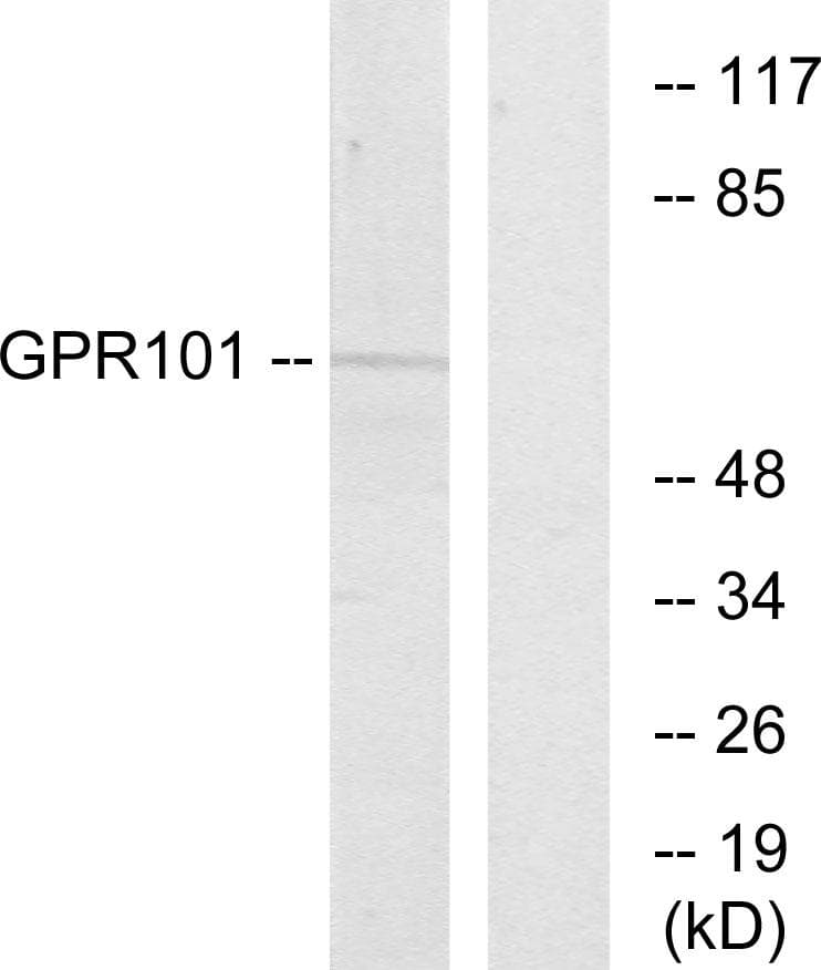Polyclonal Rabbit anti-Human GPCR6 / GPR101 Antibody (IF, WB)