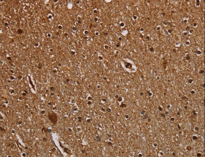 DCAF6 / NRIP Antibody