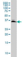 IHC-plus™ SMAD3 Antibody (clone 7F3)