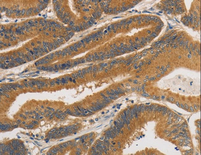 PRKD1 / PKC Mu Antibody