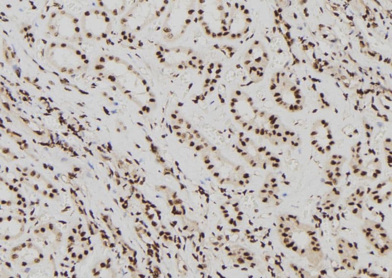 Polyclonal Rabbit anti-Human ELP2 / STATIP1 Antibody (IHC, IF, WB)