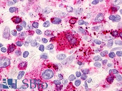 PathPlus™ RAIG2 / GPRC5B Antibody (C-Terminus)