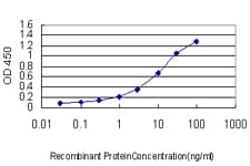 Monoclonal Mouse anti-Human ARHGDIA / RHOGDI Antibody (clone 1E12-2G11)