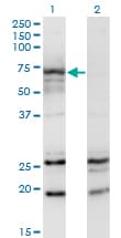 Monoclonal Mouse anti-Human GNT-III / MGAT3 Antibody (clone 2G4, WB)