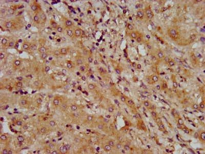 LAPTM4B Antibody