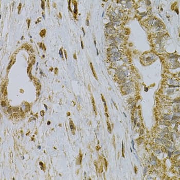 CDA / Cytidine Deaminase Antibody
