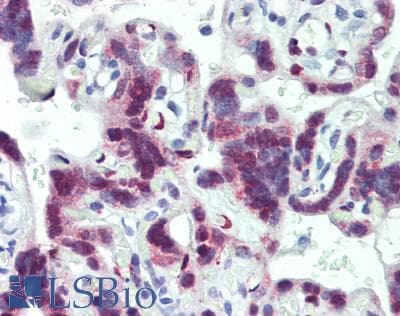 IHC-plus™ LIN28B Antibody (aa1-50)