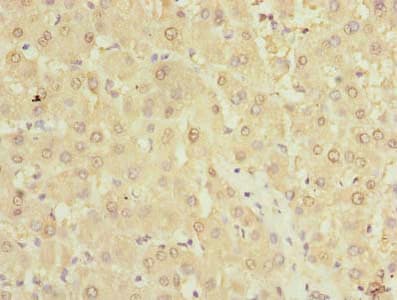 TMPRSS6 Antibody