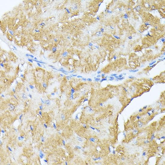 TP53I11 / PIG11 Antibody