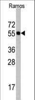 CDC6 Antibody (aa32-61)