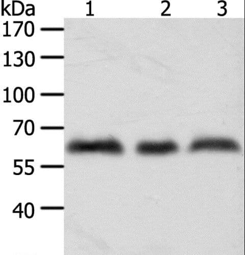 PathPlus™ Tyrosinase Antibody
