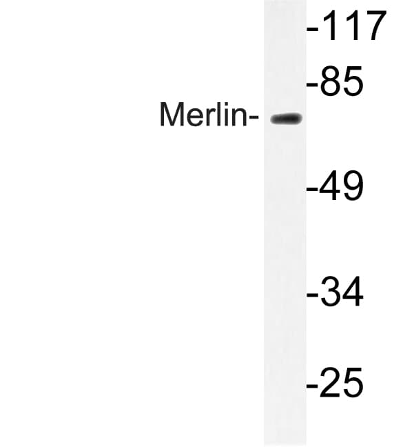 NF2 / Merlin Antibody (Thr512)