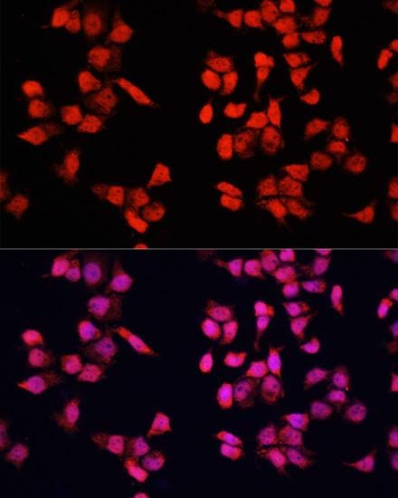 YBX1 / YB1 Antibody