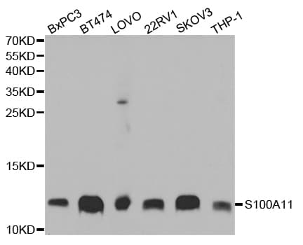 IHC-plus™ Calgizzarin / S100A11 Antibody