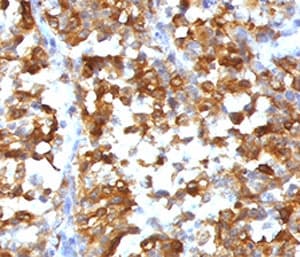 MLANA / Melan-A Antibody (clone RMMRT1-1)