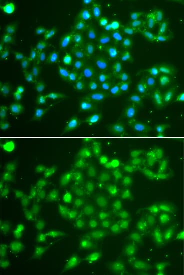Polyclonal Rabbit anti-Human UCHL5 / UCH37 Antibody (IHC, IF, WB)