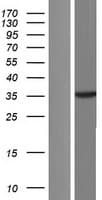 MAPK14 / p38 Protein (Over-Expression Lysate Myc-DDK (Flag))