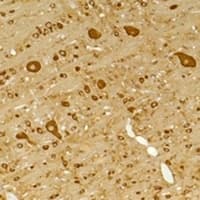 Polyclonal Rabbit anti-Human GABRG2 Antibody (IHC, WB)