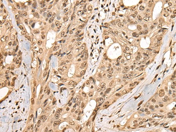 PHF21A / BHC80 Antibody