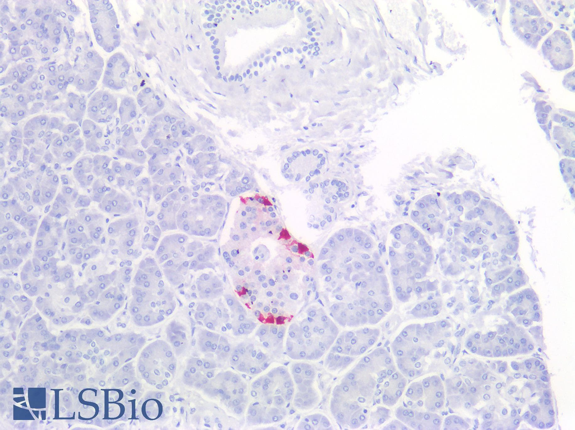 PathPlus™ PPY / Pancreatic Polypeptide Antibody