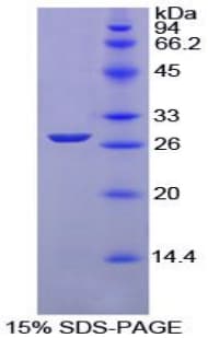 Chicken GSTM1 Protein (Recombinant His, N-Terminal)