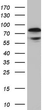 Polyclonal Rabbit anti-Human RELA / NFKB p65 Antibody (aa100-170, IHC, WB)