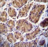 TMPRSS15 / Enterokinase Antibody (aa964-994)