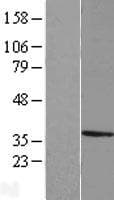MPPED2 Protein (Over-Expression Lysate Myc-DDK (Flag))