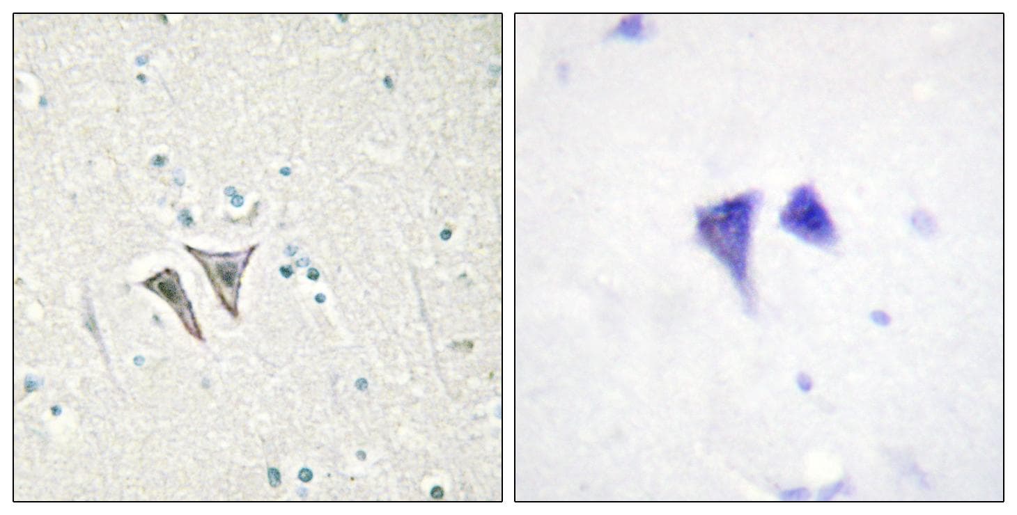 ACVR1C / ALK7 Antibody