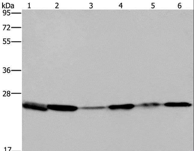 ARHGDIA / RHOGDI Antibody