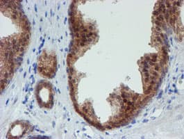 Monoclonal Mouse anti-Human Mannose Phosphate Isomerase Antibody (clone OTI4E7, IHC, WB)