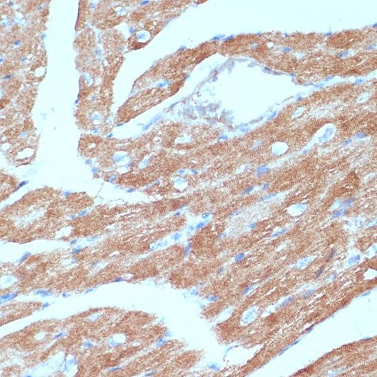 Polyclonal Rabbit anti-Human ACSL3 Antibody (IHC)