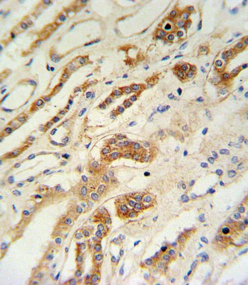 ZFYVE16 Antibody (aa375-404)