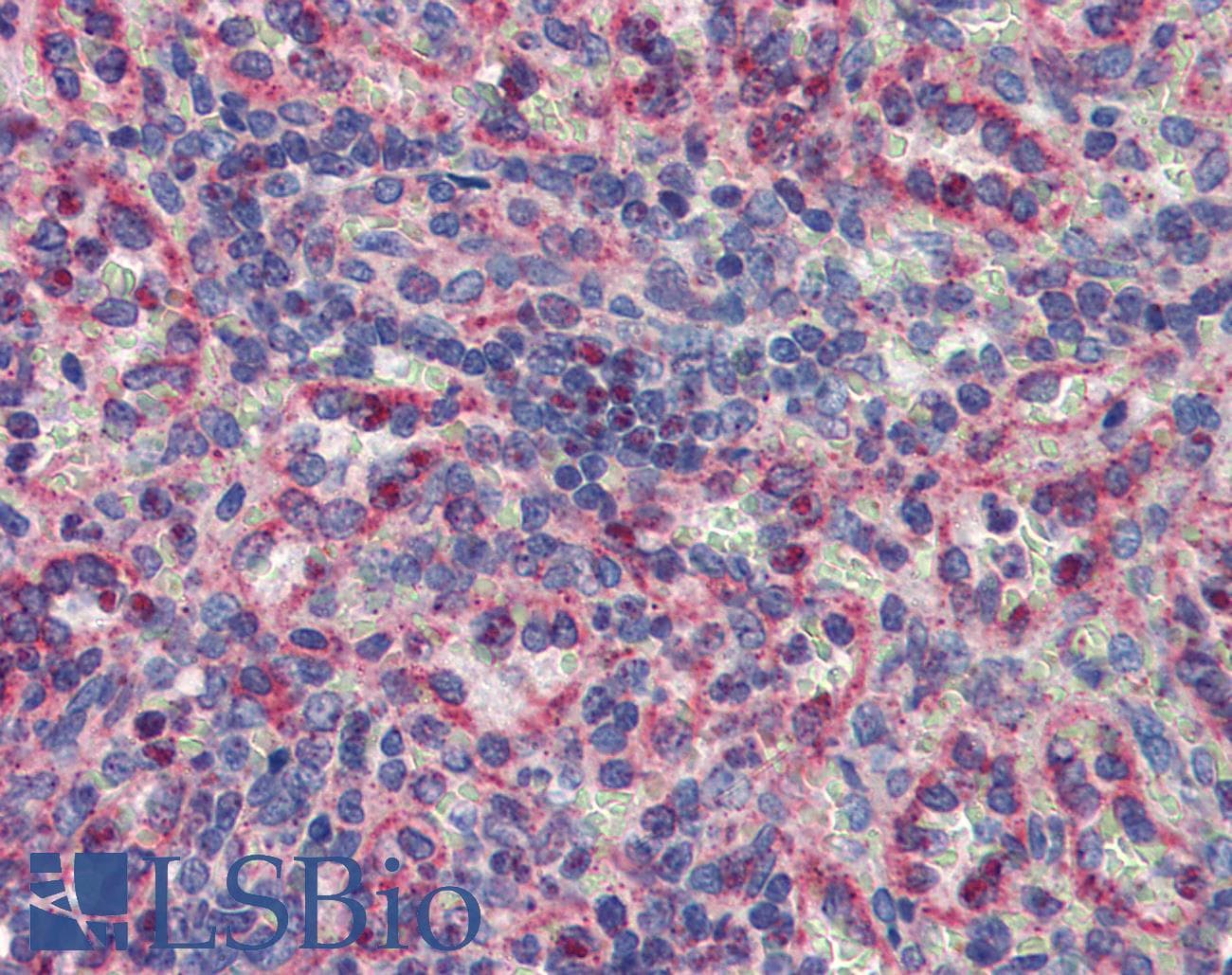 MKNK2 / MNK2 Antibody (aa36-85)