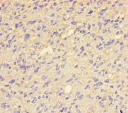 Polyclonal Rabbit anti-Human QPCT / QC Antibody (WB)