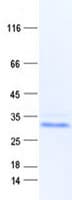 Human PAGE5 Protein (Recombinant Myc-DDK (Flag))