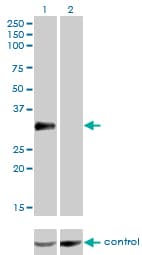 CRD / CRX Antibody (clone F6-C2)