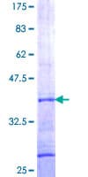 Human GGA3 Protein (Recombinant GST, N-terminus)