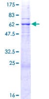 Human CDK10 Protein (Recombinant GST)