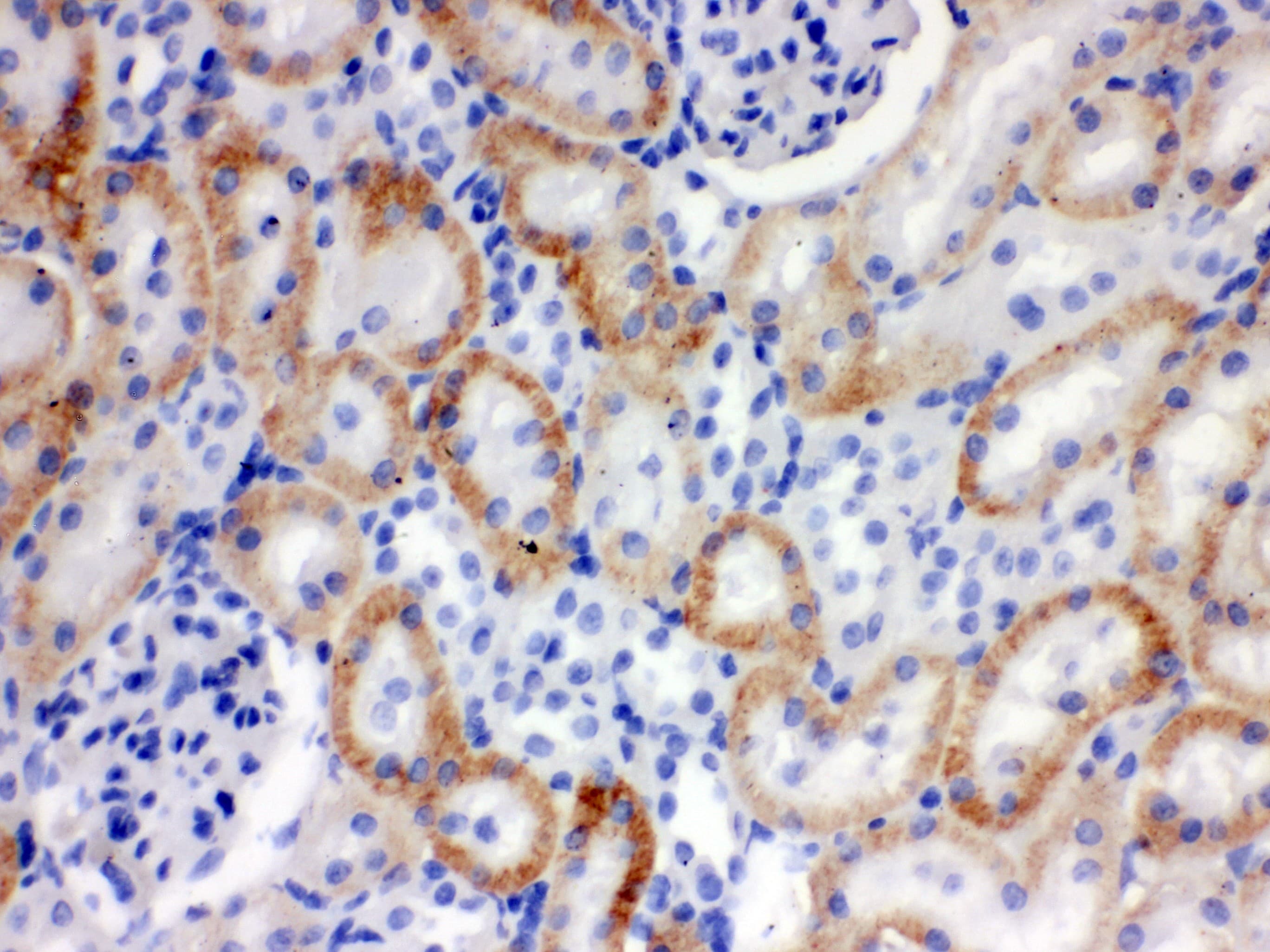 SLC22A2 Antibody (aa524-555)