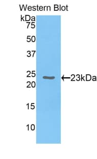 CBX3 / HP1 Gamma Antibody (aa1-183)