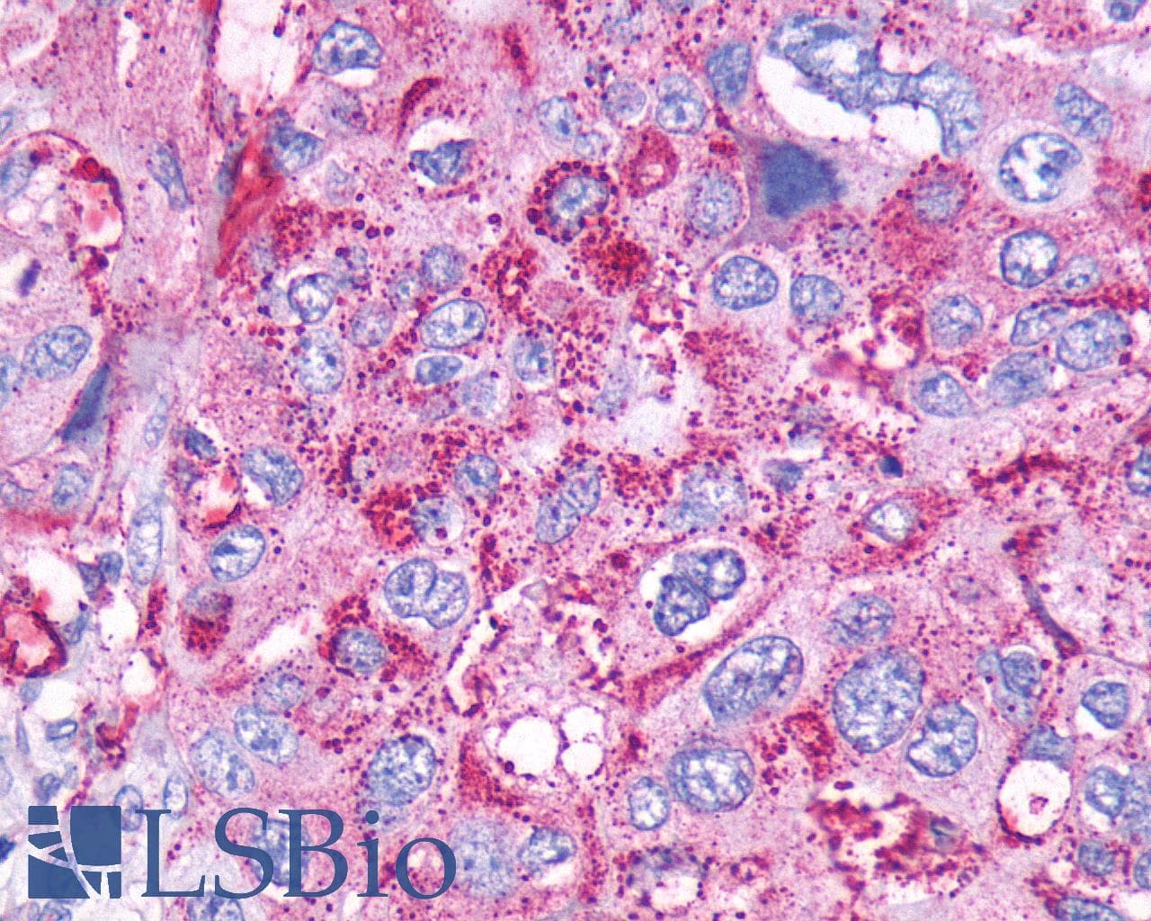 PathPlus™ Polyclonal Rabbit anti-Human CCKBR / Cckb Antibody (Cytoplasmic Domain, IHC)